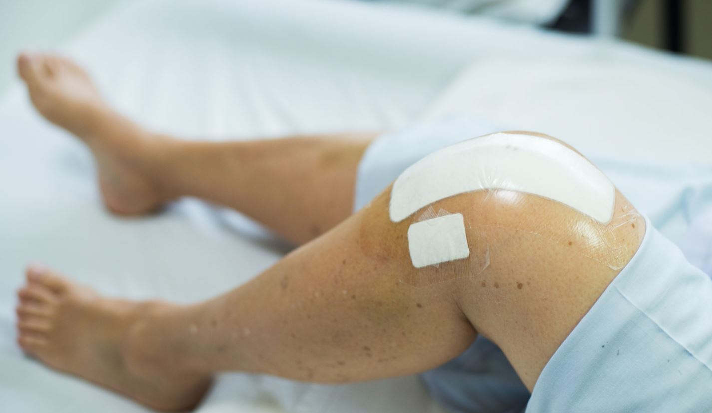 Facteurs de risque pour les patients subissant une arthroplastie du genou