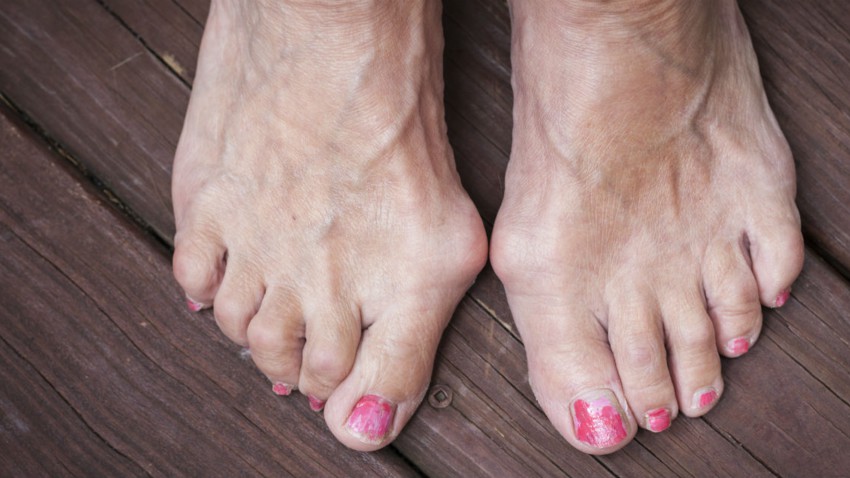 Comment le vieillissement affecte vos pieds